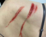Whip Marks 1