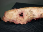 Severed Leg