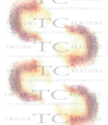 TC Bruises_12C