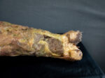 Rotten Leg