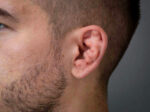 Cauliflower Ears