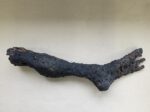Burned Foot