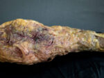 Rotten Leg