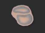 SB2 Geschwollenes Auge (links)