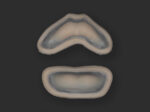 Filled Lips