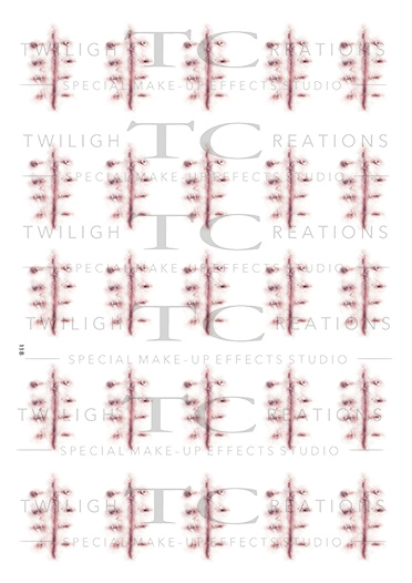 ScarsAndSutures_13B ScarsAndSutures_13B