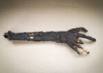 Burned Hand