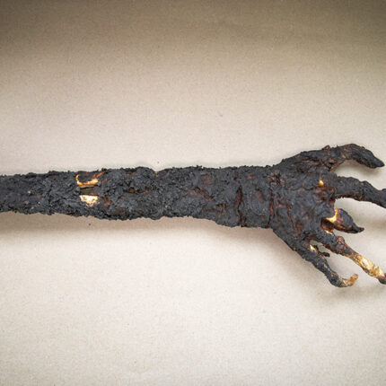 Burned Hand
