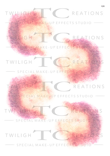 TC Bruises_12B TC Bruises_12B