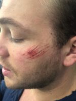 Random Wounds