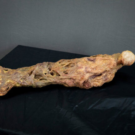 Rotten Leg