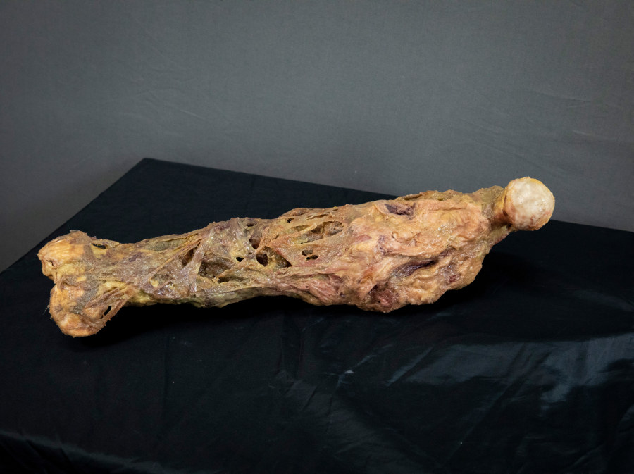 Rotten Leg Rotten Leg