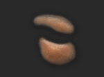 SB2 Geschwollenes Auge (links)