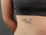 Blossom