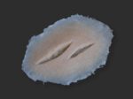 SW2 Stichwunde