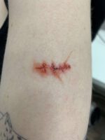 Scars and Sutures B