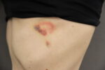 Skin Mix 1