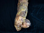 Rotten Leg
