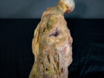 Rotten Leg