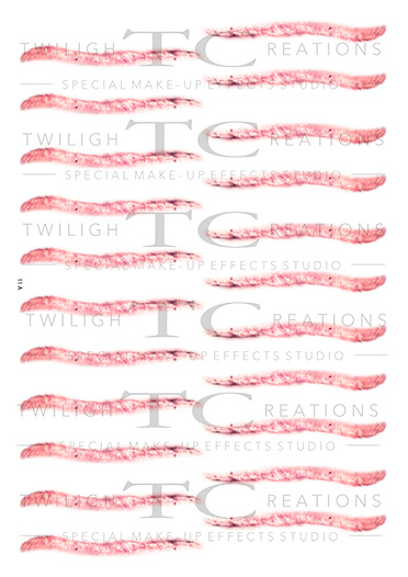 ScarsAndSutures_11A ScarsAndSutures_11A