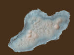 SD5 Hautkrankheit