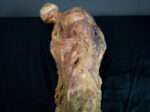 Rotten Leg