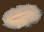 SW4 Stichwunde