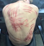Whip Marks 2