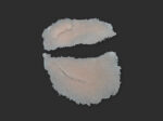 SB3 Geschwollenes Auge (links)
