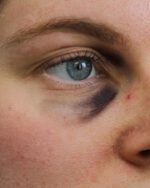 Black Eyes Set